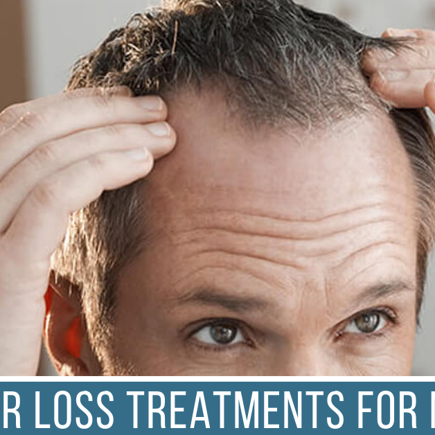 Hair Loss Treatments for Men - LuxVerve
